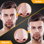 PoreClean-Sua alta estima em primeiro lugar